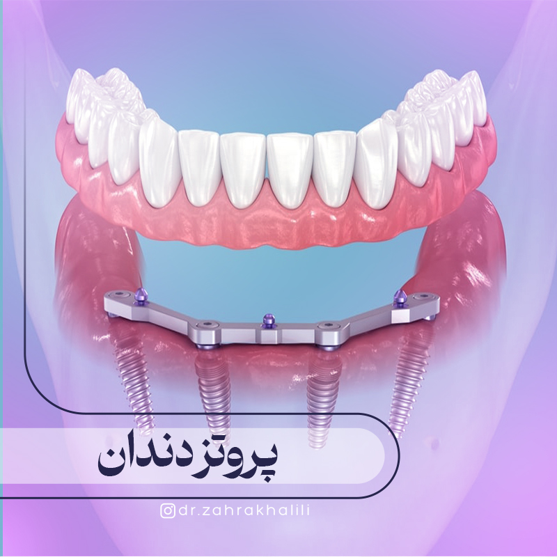 پروتز دندان چیست؟