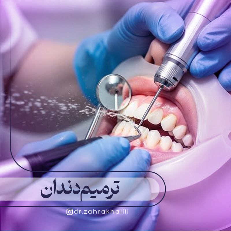 ترمیم دندان چیست؟