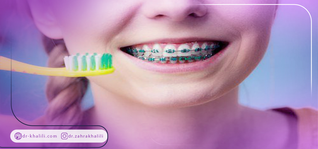 روش های ارتودنسی پیشگیرانه
