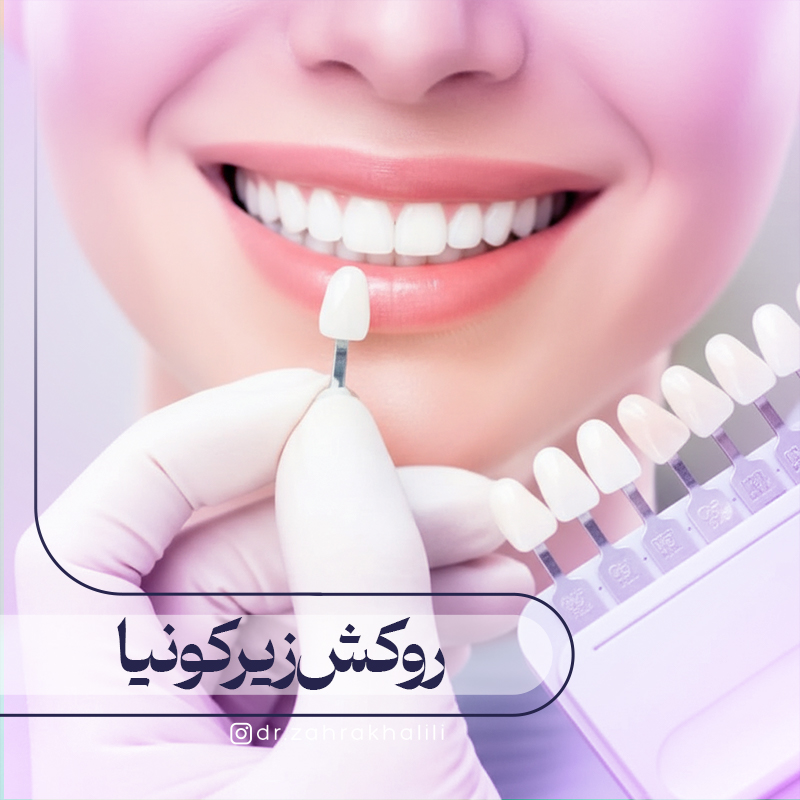 روکش زیرکونیا (زیرکونیوم) چیست؟